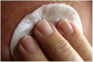 Pimple treatment 