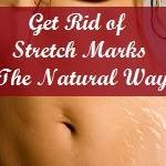 How to Get Rid of Stretch Marks The Natural Way?