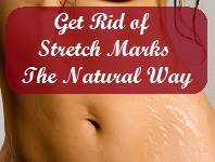 Get Rid of Stretch Marks The Natural Way