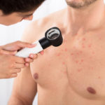 6 Tips for Getting Rid of Chest Acne