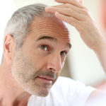 Good Reasons to Pursue a Career in Scalp Micropigmentation